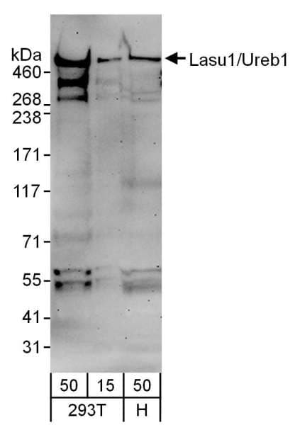 IHC-plus™ Polyclonal Goat anti-Human HUWE1 / ARFBP1 Antibody (aa2250-2300, IHC, WB)