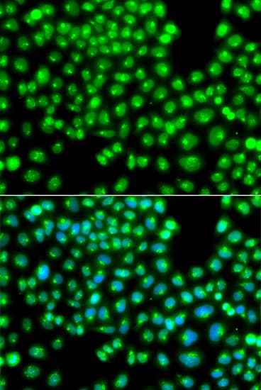 Polyclonal Rabbit anti-Human GOPC / PIST Antibody (IHC, IF, WB)