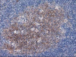 TUBB4 / Tubulin Beta 4 Antibody (clone 3C12, Carrier-free)