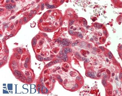 IHC-plus™ Polyclonal Rabbit anti-Human CAD Antibody (aa1850-2000, IHC, WB)