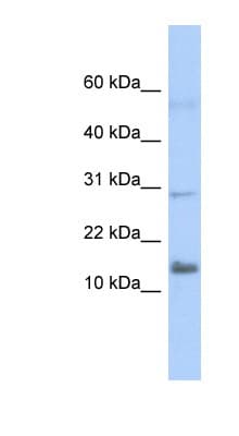 Polyclonal Rabbit anti-Human IFI27L2 Antibody (aa71-120, WB)