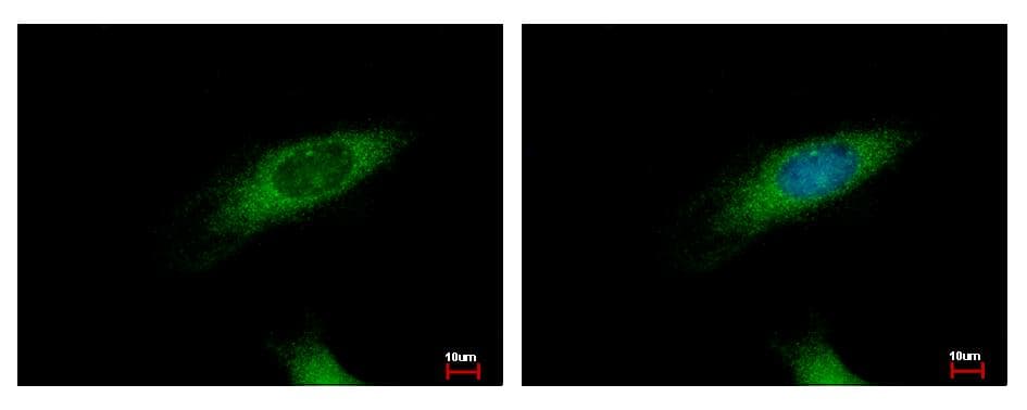 HIP1R Antibody (N-Terminus)