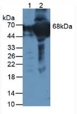 F12 / Factor XII Antibody (aa400-615)
