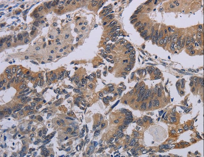 I-309 / CCL1 Antibody