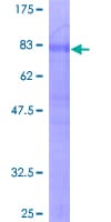 Human TNFRSF21 / DR6 Protein (Recombinant GST)
