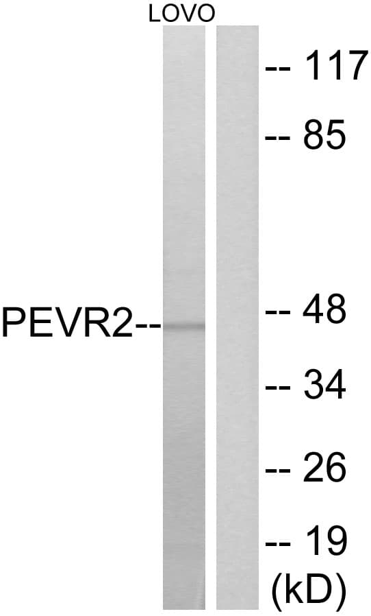 SLC52A1 / GPR172B / PAR2 Antibody (aa235-284)