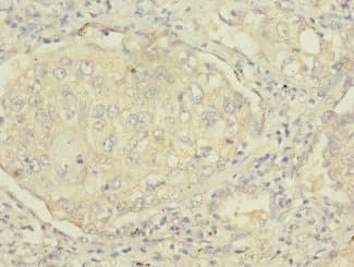 Polyclonal Rabbit anti-Human MSRB2 / MSRB Antibody (IHC, WB)
