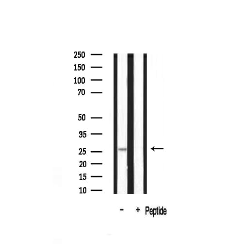 Polyclonal Rabbit anti-Human YWHAZ / 14-3-3 Zeta Antibody (IF, WB)