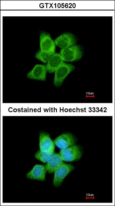 IHC-plus™ DDH / AKR1C1 Antibody (aa22-248)