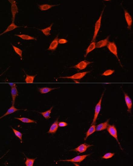 Polyclonal Rabbit anti-Human PIK3R3 / p85 Gamma Antibody (IF)