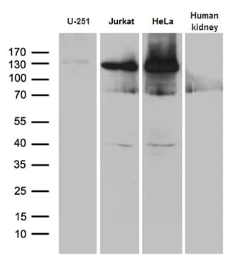 Monoclonal Mouse anti-Human SUPT16H / FACTP140 Antibody (clone OTI3B8, aa187-282, IHC, WB)
