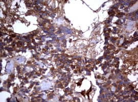 Monoclonal Mouse anti-Human PIK3C2A Antibody (clone OTI3D9, aa230-560, IHC, WB)