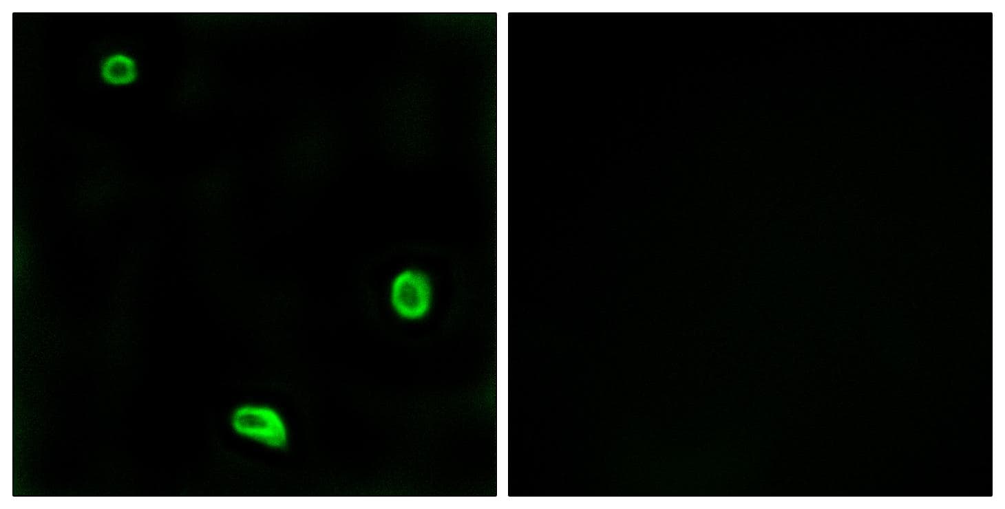 Polyclonal Rabbit anti-Human F2RL3 / PAR4 Antibody (IF, WB)