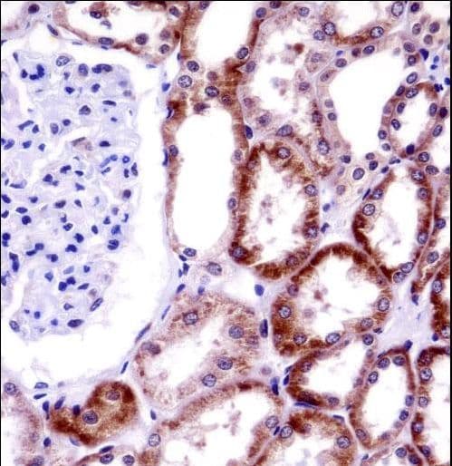 Polyclonal Rabbit anti-Human CD27L / CD70 Antibody (aa72-101, IHC, WB)