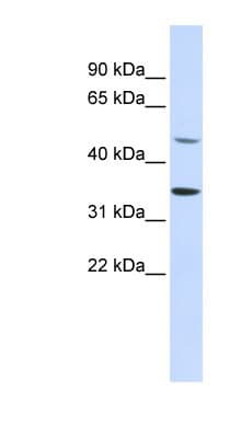 ZNF398 Antibody (aa180-229)