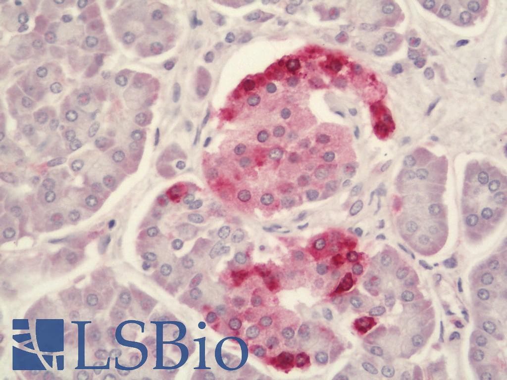 IHC-plus™ Junctin / ASPH Antibody
