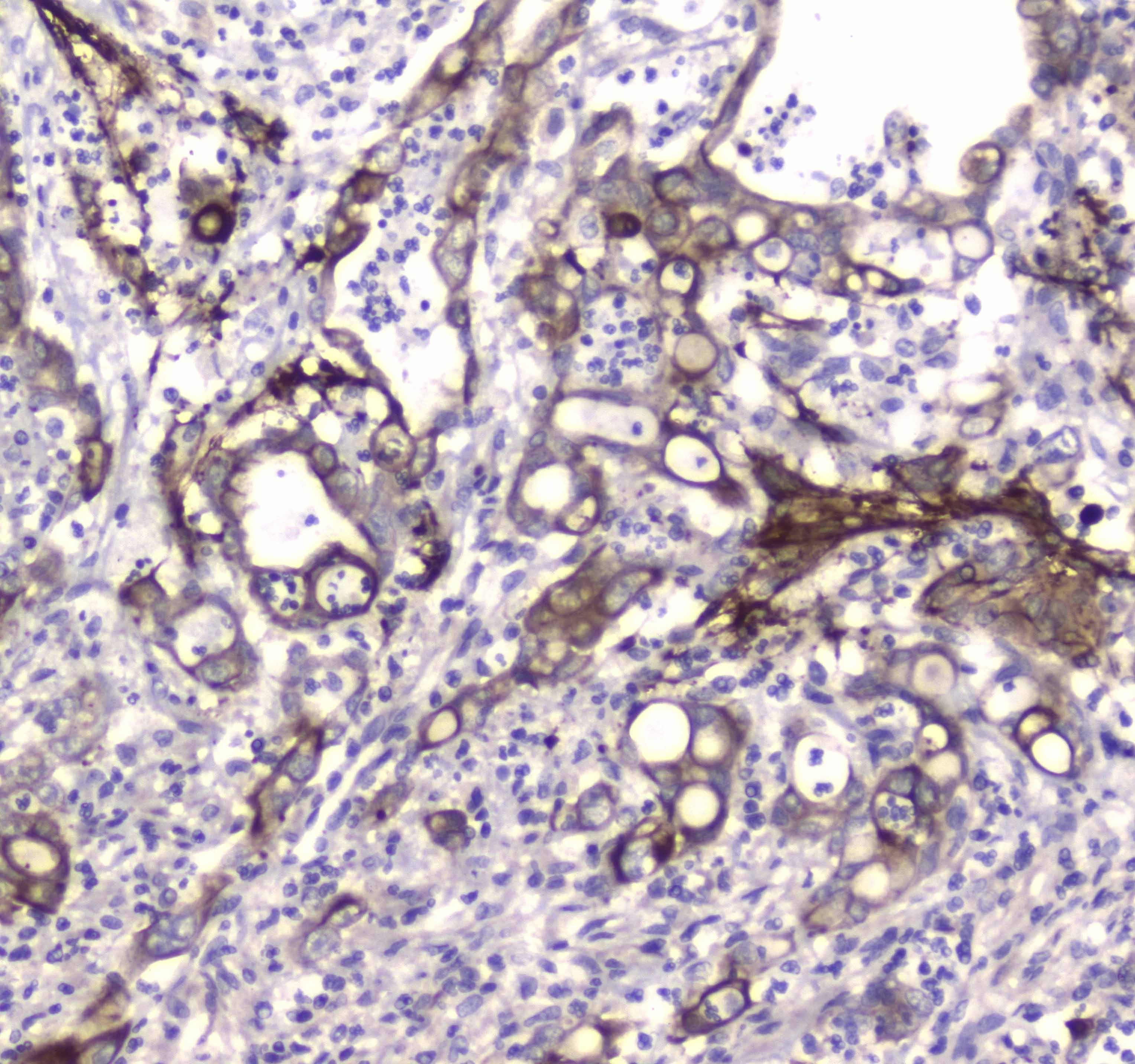 MAP1LC3A / LC3A Antibody