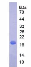 Human IL18BP Protein (Recombinant His)