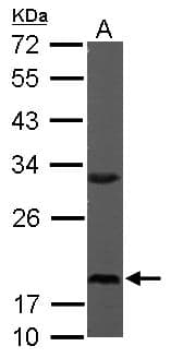 RPS10 / Ribosomal Protein S10 Antibody (aa1-151)