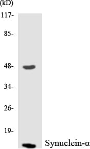 SNCA / Alpha-Synuclein Antibody (aa70-119)