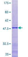 Human RPL24 / Ribosomal Protein L24 (Recombinant GST)