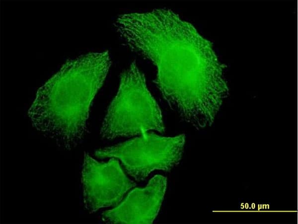 PGA5 / Pepsin A Antibody (clone 4G9)