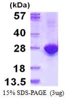 Human MYL4 Protein (Recombinant His)