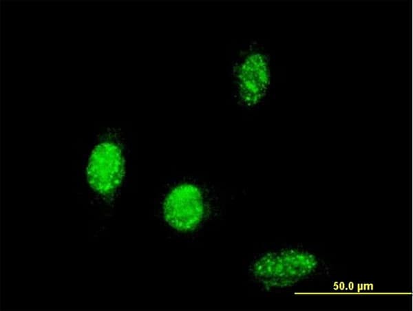 Monoclonal Mouse anti-Human TBX6 Antibody (clone 2D11, IF)
