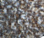 Monoclonal Mouse anti-Human CD79A / CD79 Alpha Antibody (clone JCB117, Ready-to-Use, IHC)
