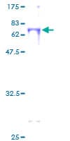 Human BBOX1 / BBOX Protein (Recombinant GST)