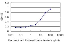 IHC-plus™ STT3A / ITM1 Antibody (clone 4D4)