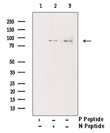 CHUK / IKKA / IKK Alpha Antibody (phospho-Ser176,pSer177)