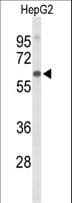 Polyclonal Rabbit anti-Human AFM / Afamin Antibody (aa49-76, WB)