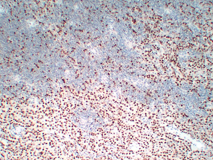WT1 / Wilms Tumor 1 Antibody (clone ABT-WT1)