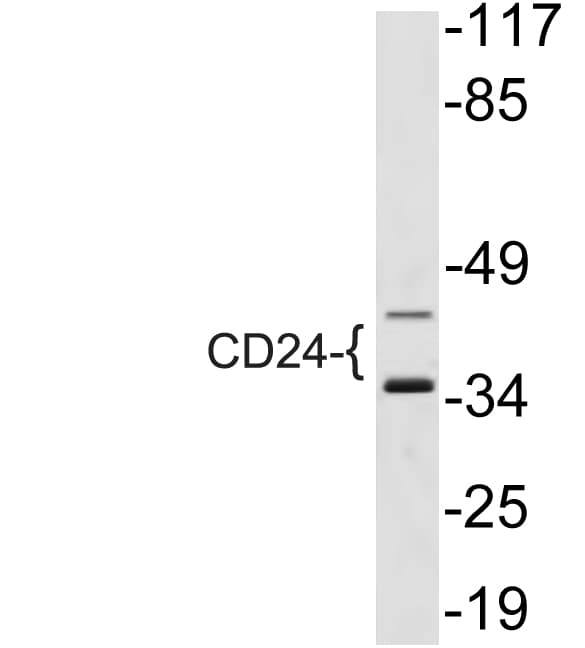 Polyclonal Rabbit anti-Human CD24 Antibody (aa14-63, WB)