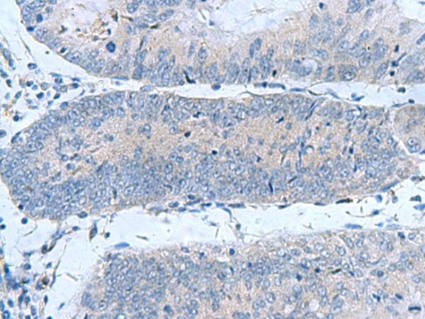 Polyclonal Rabbit anti-Human GCAP / GUCA1A Antibody (IHC)