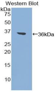 F2 / Prothrombin / Thrombin Antibody (aa324-617)