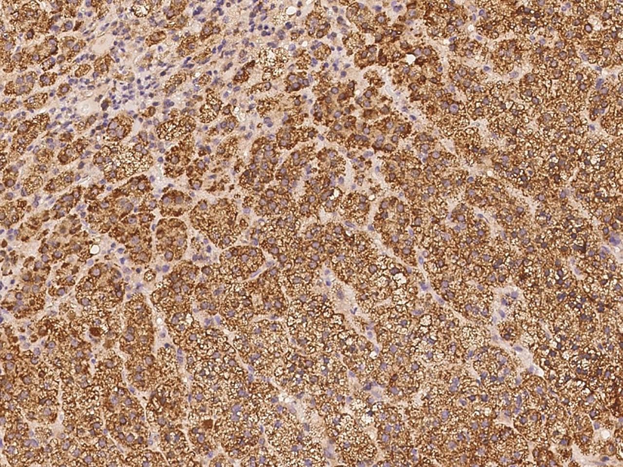 Polyclonal Rabbit anti-Human SRCIN1 / SNIP Antibody (IHC, IF)