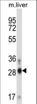 ATOH8 Antibody (aa10-39)