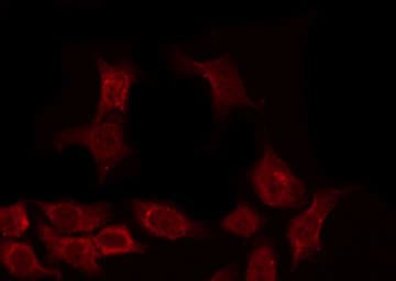 EGFR Antibody (phospho-Tyr1092)