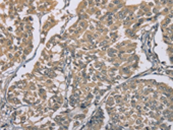ZBTB2 Antibody