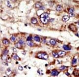 ZMPSTE24 Antibody (aa440-470)