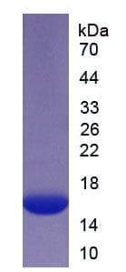 Human CD105 Protein (Recombinant His)