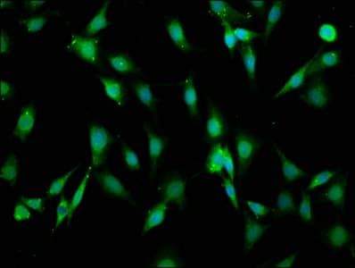 LAMA2 / Merosin Antibody