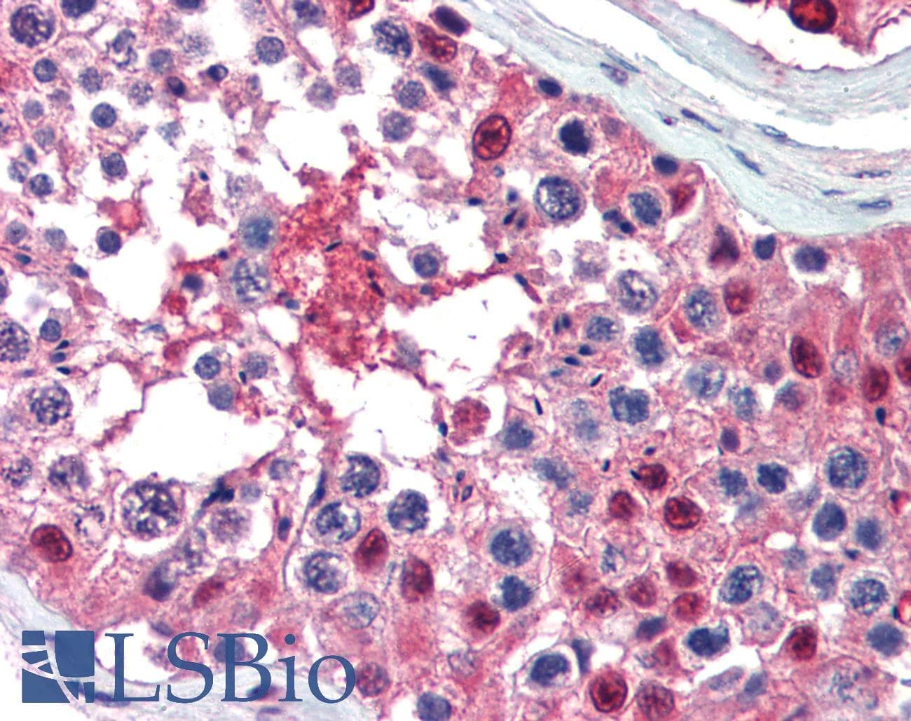 IHC-plus™ Ubiquitin Antibody