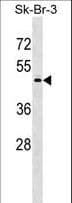 Polyclonal Rabbit anti-Human PAPD7 / TRF4-1 Antibody (aa152-180, WB)