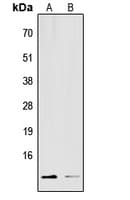 S100A16 Antibody (Internal)