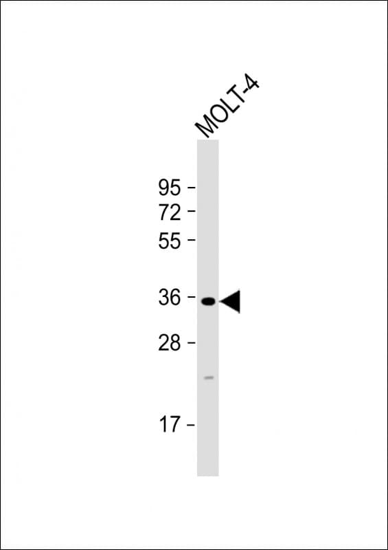 GLT6D1 Antibody (Internal)