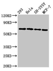 NTN1 / Netrin 1 Antibody