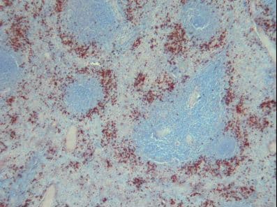 Monoclonal Mouse anti-Human S100A9 / MRP14 Antibody (clone S36-48, IHC)